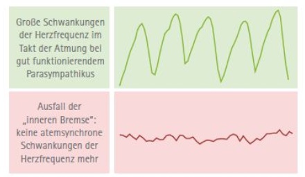 Stressanalyse mit Messung der Herzratenvariabilität (HRV) © BioSign GmbH - Veränderung der Herzfrequenz