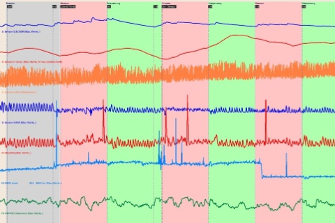 © Bernd Heiler - Psychophysiologisches Belastungsprofil