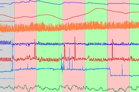 © Bernd Heiler - psychophysiologisches Stressprofil