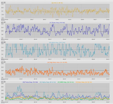 © Bernd Heiler - Neurofeedback Frequenzband-Training