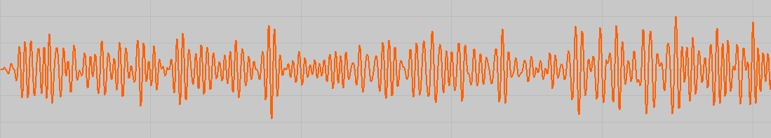 © Bernd Heiler - HiBeta-Wellen (21 - 35 Hz)