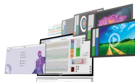 Herzbiofeedback mit HRV-Scanner und MindMedia NeXus / BioTrace+ © MindMedia B.V. (Ausschnitt)