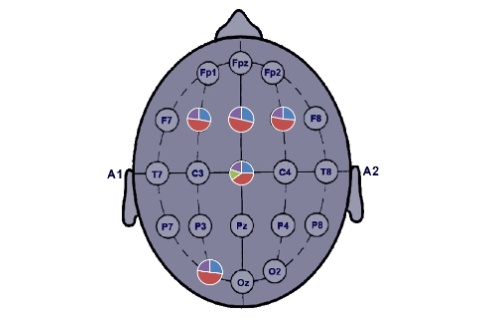 Braimap mit Neurofeedback © Bernd Heiler - Brainmap