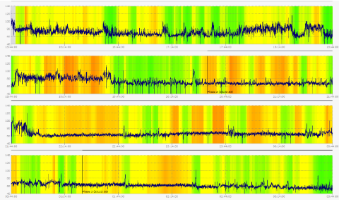 © Bernd Heiler - Aufzeichnung der HRV über 24 Stunden